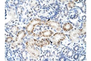 PPP1R8 antibody was used for immunohistochemistry at a concentration of 4-8 ug/ml to stain Epithelial cells of renal tubule (arrows) in Human Kidney. (PPP1R8 抗体)