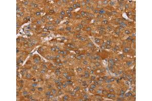 Immunohistochemistry (IHC) image for anti-P Antigen Family, Member 5 (Prostate Associated) (PAGE5) antibody (ABIN2423933) (PAGE5 抗体)