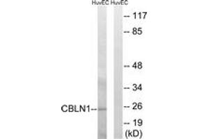 Western blot analysis of extracts from HuvEc cells, using CBLN1 Antibody. (CBLN1 抗体  (AA 131-180))