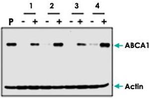 Western blot analysis of ABCA1 induction by cholesterol (+) in human fibroblast cells from different patients (1, 2, 3, 4). (ABCA1 抗体  (AA 1800-2260))