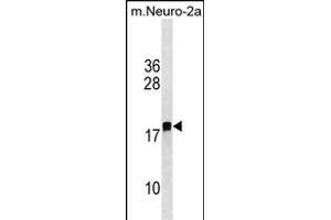 LDOC1L Antibody (C-term) (ABIN1536754 and ABIN2850058) western blot analysis in mouse Neuro-2a cell line lysates (35 μg/lane). (LDOC1L 抗体  (C-Term))