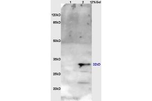 Lane 1: myeloma cell s/p20 lysates Lane 2: mouse brain lysates probed with Anti OTX1 + OTX2 Polyclonal Antibody, Unconjugated (ABIN1387702) at 1:200 in 4 °C. (Otx1 + Otx2 (AA 21-120) 抗体)