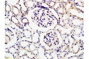 Formalin-fixed and rat kidney tissue labeled with Anti-KLK1 Polyclonal Antibody , Unconjugated at 1:200 followed by conjugation to the secondary antibody and DAB staining (Kallikrein 1 抗体  (AA 101-200))
