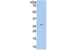 WB of Protein Standard: different control antibodies  against Highly purified E.
