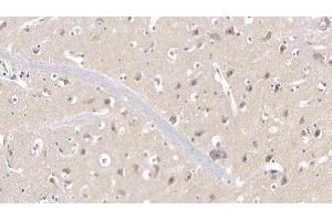 Detection of CDK1 in Human Cerebrum Tissue using Polyclonal Antibody to Cyclin Dependent Kinase 1 (CDK1) (CDK1 抗体  (AA 59-182))