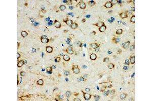 IHC-P: XRCC3 antibody testing of rat brain tissue (XRCC3 抗体  (C-Term))