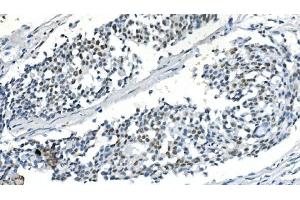 IHC analysis of PPM1A using anti-PPM1A antibody (ABIN7603116).