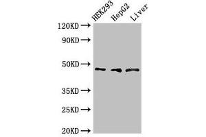 Western Blot Positive WB detected in: HEK293 whole cell lysate, HepG2 whole cell lysate, Rat liver tissue All lanes: ACADSB antibody at 3 μg/mL Secondary Goat polyclonal to rabbit IgG at 1/50000 dilution Predicted band size: 48, 37 kDa Observed band size: 48 kDa (ACADSB 抗体  (AA 34-253))