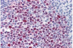 Human Tonsil: Formalin-Fixed, Paraffin-Embedded (FFPE) (EPSTI1 抗体  (AA 1-101))