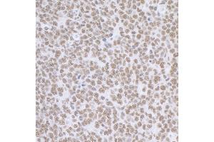 Immunohistochemistry (IHC) image for anti-Breast Carcinoma Amplified Sequence 2 (BCAS2) (C-Term) antibody (ABIN7453423) (BCAS2 抗体  (C-Term))