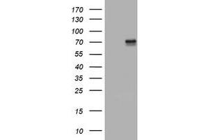 Image no. 6 for anti-Tumor Necrosis Factor Receptor Superfamily, Member 8 (TNFRSF8) (AA 19-379) antibody (ABIN1491087) (TNFRSF8 抗体  (AA 19-379))
