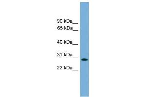 Human Jurkat; WB Suggested Anti-APOLD1 Antibody Titration: 0. (APOLD1 抗体  (Middle Region))
