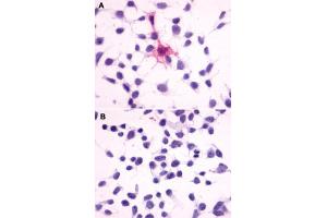 Immunocytochemistry (ICC) staining of HEK293 human embryonic kidney cells transfected (A) or untransfected (B) with MC4R. (MC4R 抗体  (Extracellular Domain))