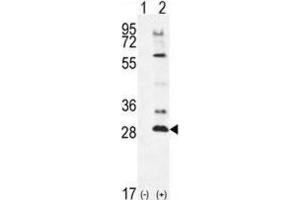 Western Blotting (WB) image for anti-Testis Specific Serine Kinase 4 (TSSK4) antibody (ABIN2996104) (TSSK4 抗体)