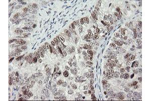 Image no. 12 for anti-Replication Factor C (Activator 1) 2, 40kDa (RFC2) (AA 1-234) antibody (ABIN1490616)