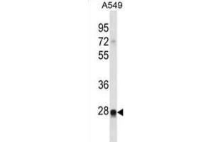 Western Blotting (WB) image for anti-Ras-Like Without CAAX 2 (RIT2) antibody (ABIN2998826) (RIT2 抗体)