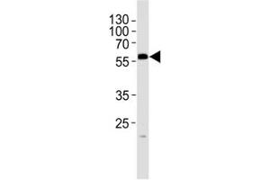Western blot analysis of lysate from mouse testis tissue lysate using PHF1 antibody at 1:1000. (PHF1 抗体  (N-Term))