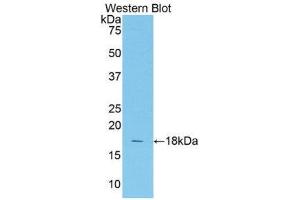 Western Blotting (WB) image for anti-Transcription Factor 20 (TCF20) (AA 1656-1792) antibody (ABIN1860688) (TCF20 抗体  (AA 1656-1792))