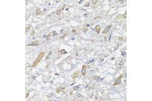 Immunohistochemistry of paraffin-embedded rat brain using SPICE1 antibody at dilution of 1:100 (x40 lens). (SPICE1 抗体)
