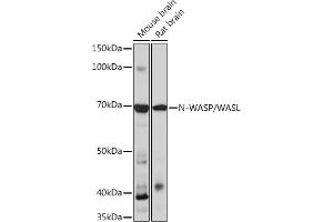 Western blot analysis of extracts of various cell lines, using N-WASP/N-WASP/WASL Rabbit mAb (ABIN7268856) at 1:1000 dilution. (Neural Wiskott-Aldrich syndrome protein (WASL) 抗体)