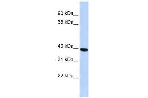 Western Blot showing HYAL1 antibody used at a concentration of 1. (HYAL1 抗体  (N-Term))