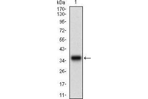 Western blot analysis using CSNK2B mAb against human CSNK2B (AA: FULL(1-215)) recombinant protein. (CSNK2B 抗体  (AA 1-215))