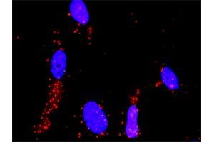Proximity Ligation Analysis of protein-protein interactions between MAP2K3 and MAP3K4. (MAP3K4 抗体  (AA 1201-1300))