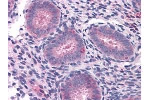 Human Uterus: Formalin-Fixed, Paraffin-Embedded (FFPE) (ELP3/KAT9 抗体)