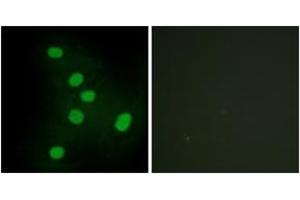 Immunofluorescence analysis of HepG2 cells, using NR2F6 Antibody. (NR2F6 抗体  (AA 11-60))