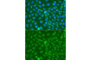 Immunofluorescence analysis of A549 cell using SRGN antibody. (SRGN 抗体)