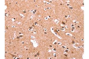 The image on the left is immunohistochemistry of paraffin-embedded Human brain tissue using ABIN7190731(GABRA1 Antibody) at dilution 1/30, on the right is treated with synthetic peptide. (GABRA1 抗体)