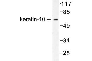 Image no. 1 for anti-Keratin 10 (KRT10) antibody (ABIN265492) (Keratin 10 抗体)