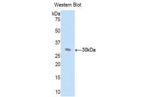 Western Blotting (WB) image for anti-Complement Factor D (CFD) (AA 1-259) antibody (ABIN3205986) (Adipsin 抗体  (AA 1-259))