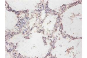 Immunohistochemistry of paraffin-embedded human lung tissue using ABIN7160982 at dilution of 1:100 (CYB5R3 抗体  (AA 1-301))