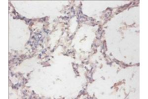 Immunohistochemistry of paraffin-embedded human lung tissue using ABIN7160982 at dilution of 1:100