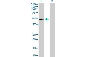 Western Blot analysis of MEIS3 expression in transfected 293T cell line by MEIS3 MaxPab polyclonal antibody. (MEIS3 抗体  (AA 1-421))
