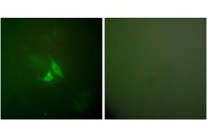 Immunofluorescence analysis of A549 cells, using PTGS2 antibody (ABIN5976369). (PTGS2 抗体  (C-Term))