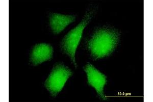 Immunofluorescence of monoclonal antibody to RANBP3 on HeLa cell. (RanBP3 抗体  (AA 298-397))
