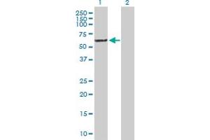 Western Blot analysis of TOE1 expression in transfected 293T cell line by TOE1 MaxPab polyclonal antibody. (TOE1 抗体  (AA 1-510))