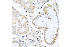 Immunohistochemistry of paraffin-embedded human stomach using INPP5K antibody (ABIN5975191) at dilution of 1/100 (40x lens). (INPP5K 抗体)
