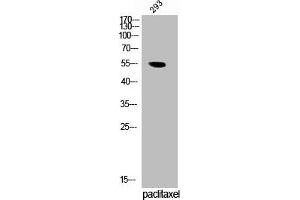 Western Blot analysis of 293 cells using Phospho-TRF1 (S219) Polyclonal Antibody (TRF1 抗体  (pSer219))