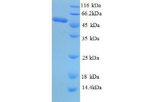SDS-PAGE (SDS) image for Proteinase 3 (PRTN3) (AA 28-248) protein (GST tag) (ABIN6653943) (PRTN3 Protein (AA 28-248) (GST tag))
