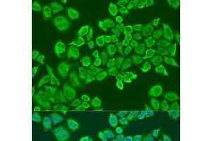 Immunofluorescence analysis of U2OS cells using IGF2BP2 Polyclonal Antibody at dilution of 1:100. (IGF2BP2 抗体)