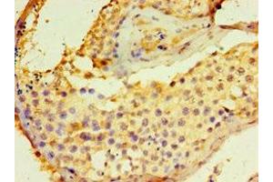 Immunohistochemistry of paraffin-embedded human testis tissue using ABIN7149845 at dilution of 1:100 (DGKE 抗体  (AA 40-260))