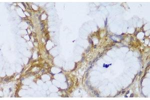 Immunohistochemistry (Paraffin-embedded Sections) (IHC (p)) image for anti-GRIP and Coiled-Coil Domain Containing 2 (GCC2) antibody (ABIN7257385)