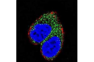 Confocal immunofluorescent analysis of AIM2 Antibody (N-term) (ABIN653833 and ABIN2843099) with MCF-7 cell followed by Alexa Fluor 488-conjugated goat anti-rabbit lgG (green). (AIM2 抗体  (N-Term))