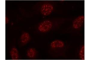 Image no. 1 for anti-Mitogen-Activated Protein Kinase-Activated Protein Kinase 2 (MAPKAPK2) (pThr334) antibody (ABIN197079) (MAPKAP Kinase 2 抗体  (pThr334))