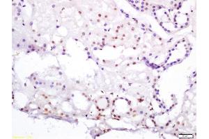 Formalin-fixed and paraffin embedded human kidney labeled with Anti-HNF4/TCF4/HNF4A Polyclonal Antibody, Unconjugated (ABIN704711) at 1:200 followed by conjugation to the secondary antibody and DAB staining (HNF4A 抗体  (AA 301-400))