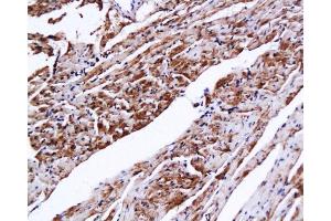 Formalin-fixed and paraffin embedded mouse heart tissue with Anti-CTn1/Troponin I/TNNC1 Polyclonal Antibody, Unconjugated  at 1:200, followed by conjugation to the secondary antibody and DAB staining