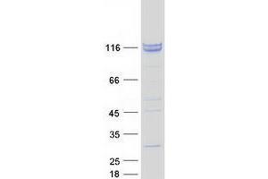 Validation with Western Blot (ZCCHC8 Protein (Myc-DYKDDDDK Tag))
